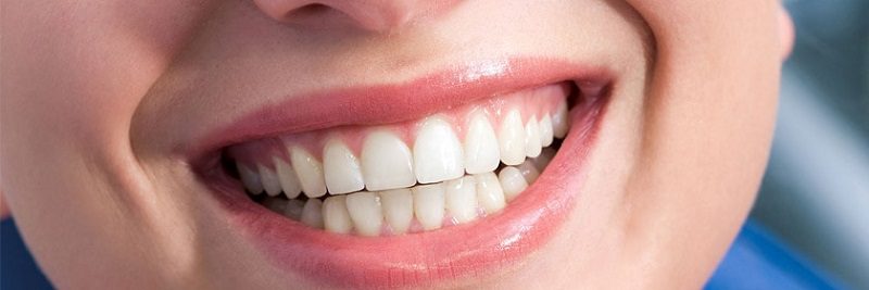 What-is-Periodontics.jpg
