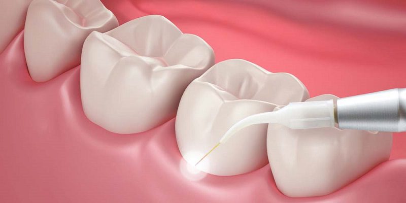 gum-disease-treatment.jpg