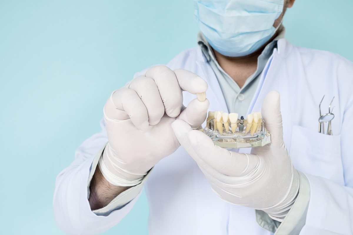 implant-orthodontic-model-student-learning-teaching-model-showing-teeth.jpg