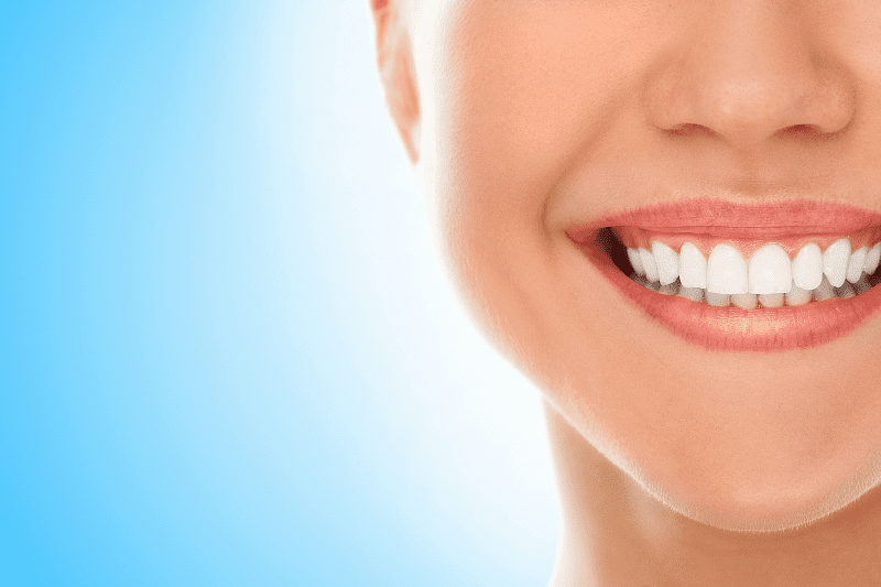 teeth-whitening.png